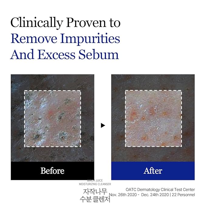 ROUND LAB Birch Juice Moisturizing Cleanser | Unclogs hidden sebum, Clears away dead skin cells., Soothing, Low pH, Gel Type Cleanser (5.07 fl.oz)