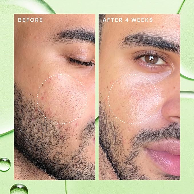 Farmacy 2% Salicylic Acid Toner for Face - Deep Sweep Gentle BHA Exfoliant for Oily Skin - Refines Texture with Papaya Enzymes & Moringa Water for a Healthy-Looking Complexion (120ml) Farmacy